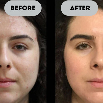 DermaNova™ - Anti-Aging Booster Pro