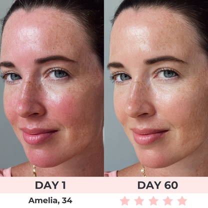 SkinSync™ - LED Face Mask